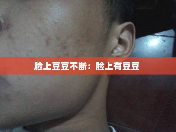脸上豆豆不断：脸上有豆豆 