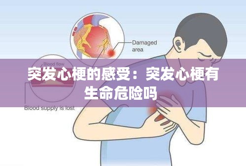 突发心梗的感受：突发心梗有生命危险吗 