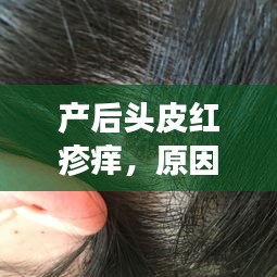 产后头皮红疹痒，原因解析及应对之法