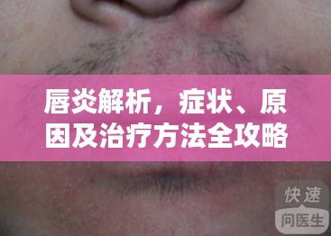 唇炎解析，症状、原因及治疗方法全攻略