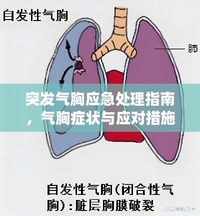 突发气胸应急处理指南，气胸症状与应对措施全解析